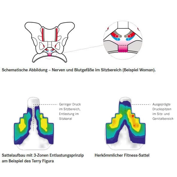 Terry Butterfly Arteria Gel Women Damen-Fahrradsattel 6 Terry Butterfly Arteria Gel Women Damen-Fahrradsattel – Bild 4